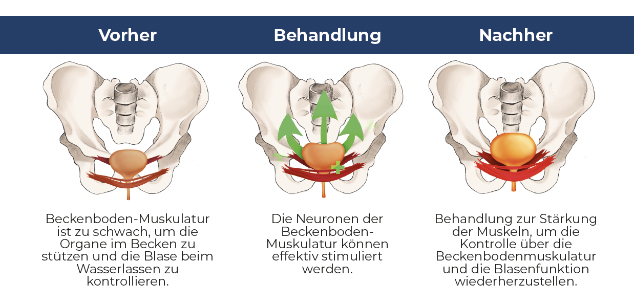 Vorher, Behandlung, Nachher